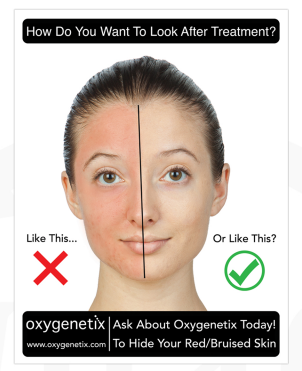 Oxygenetix Counter Stand