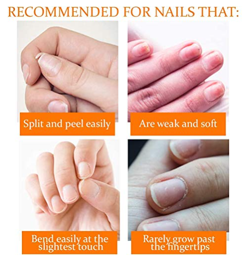 Nail Tek Nail Nutrition Kit - NEW